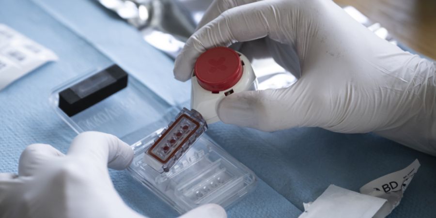 Sollte eine Person dem Doping-Statut von Swiss Olympic unterstellt sein, droht ein Disziplinarverfahren bis hin zu einer Sperre. (Archivbild)