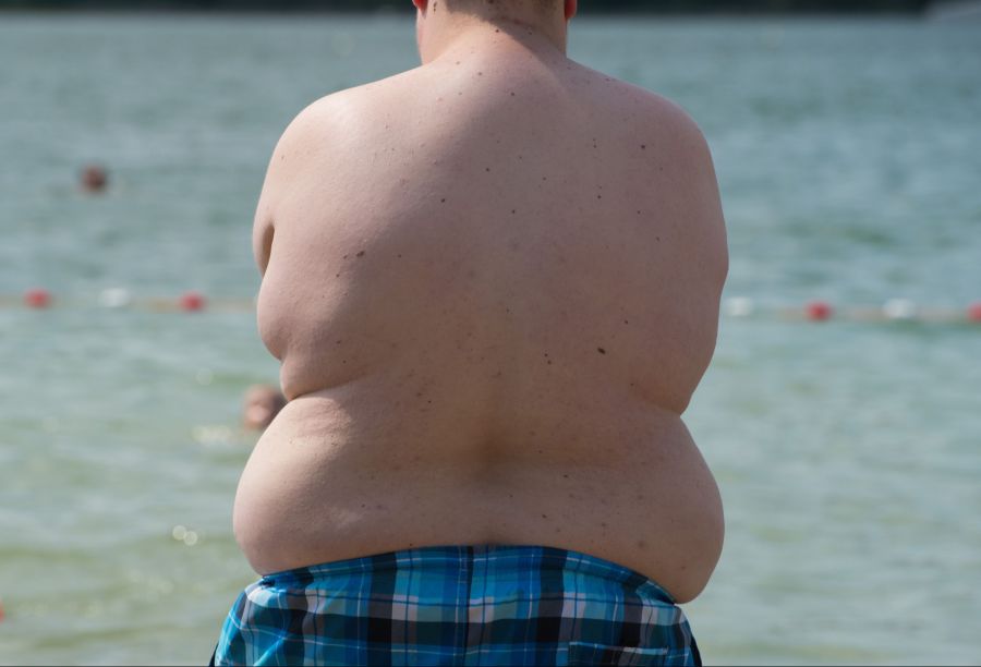 Adipositas galt lange als Wohlstandsproblem.