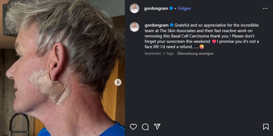 gordon ramsay instagram pflaster