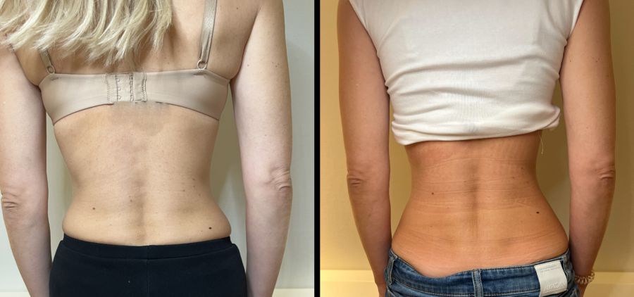 Auch die Taille gewinnt sichtbar an neuer Form.