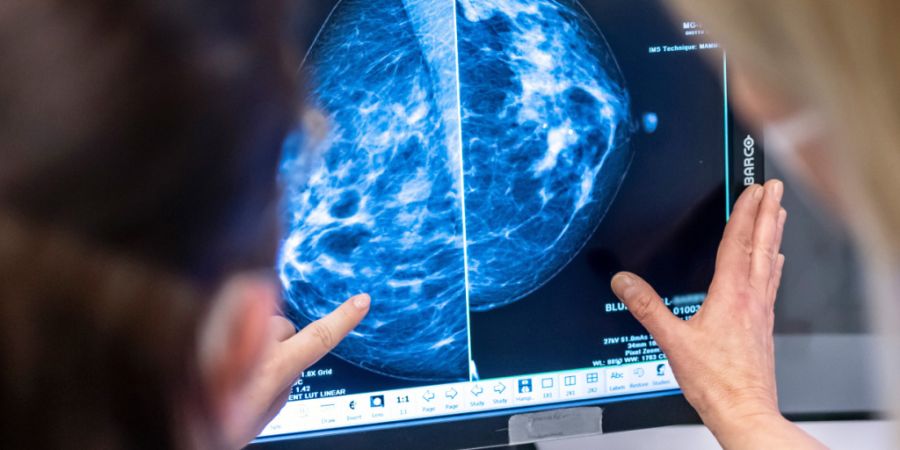 Der Schaffhauser Regierungsrat will so rasch wie möglich ein Brustkrebs-Früherkennungsprogramm einführen. (Symbolbild)