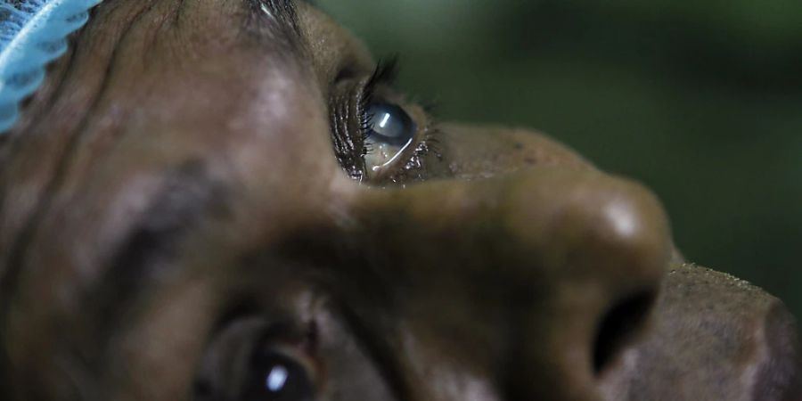 Bei gewissen Krankheiten der Augenhornhaut drängt sich eine Transplantation auf: Patient in einer Klinik der Augenspende-Gesellschaft in Sri Lanka. (Archivbild)