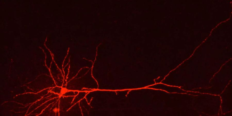 Morphologische Rekonstruktion eines Neurons des cingulären Kortex bei Migräne. Durch genetische Veränderung des «Bösewichts», des mutierten Astrozyten, konnten Forscher der Uni Zürich bei Mäusen das Kopfweh reduzieren. Etwa 15 Prozent der Menschheit - alles Migräne-Opfer - hoffen nun.  (UZH)