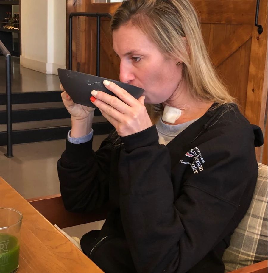 Nach den Operationen musste sie wieder lernen zu essen und zu trinken.