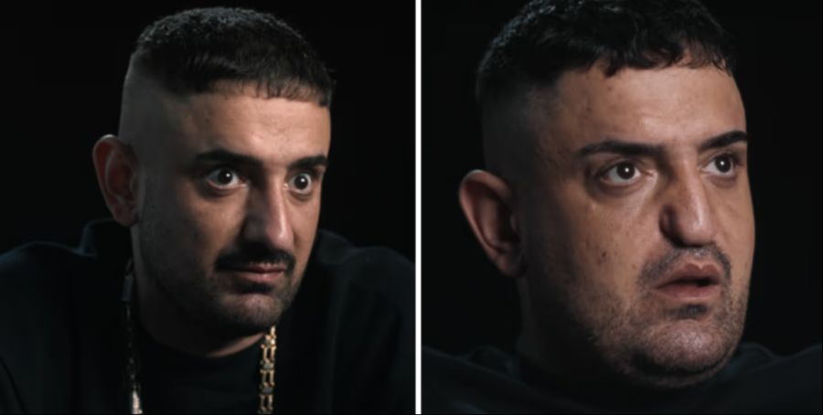 Die Vorher-Nachher-Bilder von Haftbefehl schockierten. Der Rapper hat sich seine Nase weggekokst.