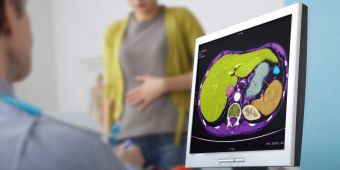 Arztbesuch, Organe auf einem Bildschirm