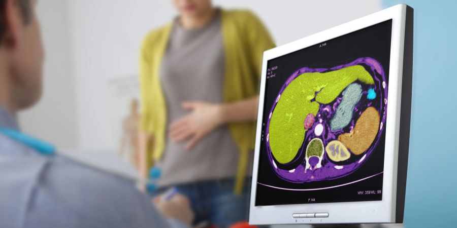 Arztbesuch, Organe auf einem Bildschirm