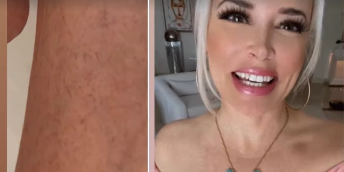 «Wie ein Reh» - Daniela Katzenberger zeigt ihre Beinbehaarung