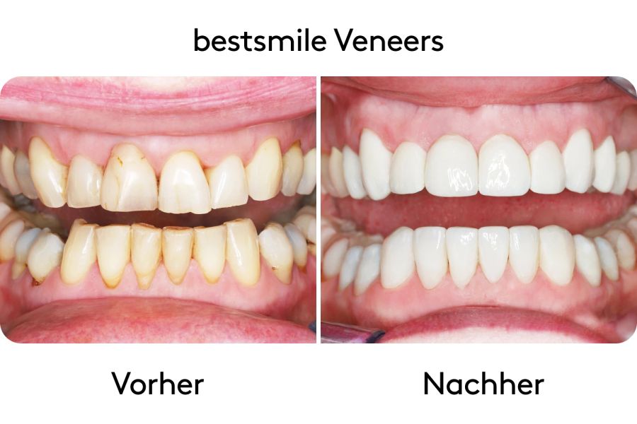Vorher-Nachher Bilder