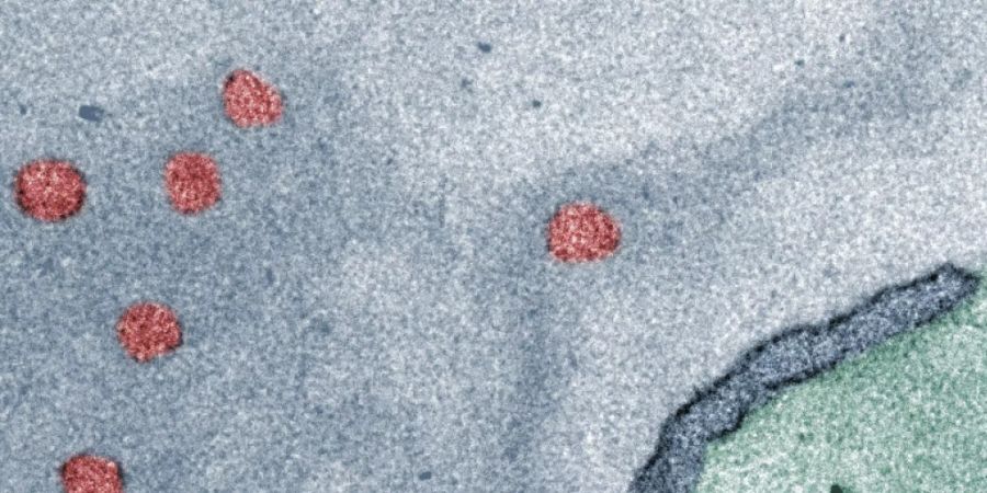 Sieht fast aus wie moderne Kunst: Die roten Punkte sind die neuartigen Nanocontainer im Zellkern (grau). Diese winzigen Behälter haben die nötige Beschaffenheit und den «Zugangscode», um ihre Fracht in den Zellkern zu bringen.