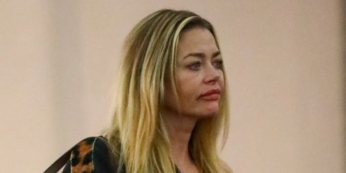 Dicke Lippe - Charlie-Sheen-Ex Denise Richards kaum wiederzuerkennen