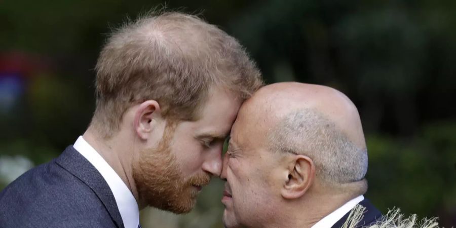 Auch seinem jüngeren Bruder Prinz Harry gehen bereits die Haare aus.