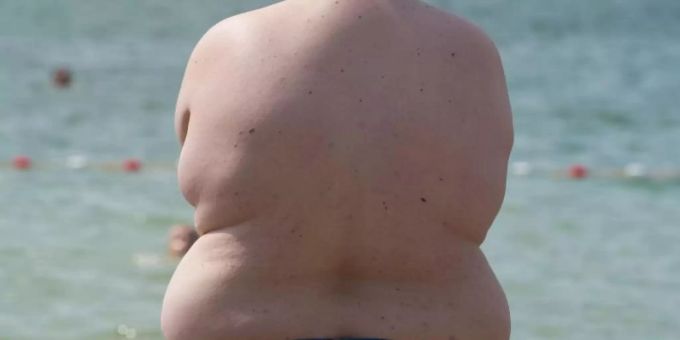 Ein übergewichtiger Junge steht an einem Badesee am Wasser. Foto: Sebastian Kahnert Ein übergewichtiger Junge steht an einem Badesee am Wasser. Foto: Sebastian Kahnert