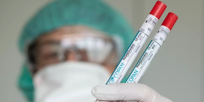 Die Romandie und das Tessin sind von der Corona-Krise heftiger getroffen worden als die Deutschschweiz. Coronavirus Romandie
