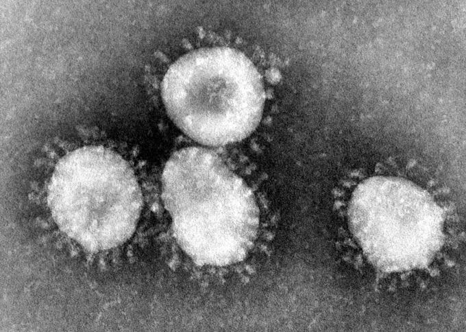 Ein Sars-assoziiertes Coronavirus könnte bei der Krankheit in China der Ursprung sein. (Archivbild) Coronavirus