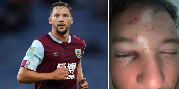 Nächster Eklat - Burnley-Profi Danny Drinkwater vor Club verprügelt!