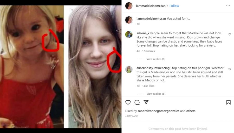 Auf Instagram hat die 21-Jährige einen Account eröffnet und postet zahlreiche Vergleichsbilder.