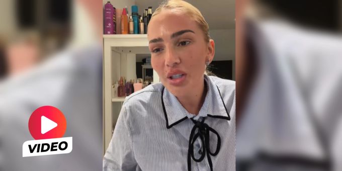 «Komplexe» - Loredana gesteht Beauty-Eingriffe – ist aber «nicht stolz»