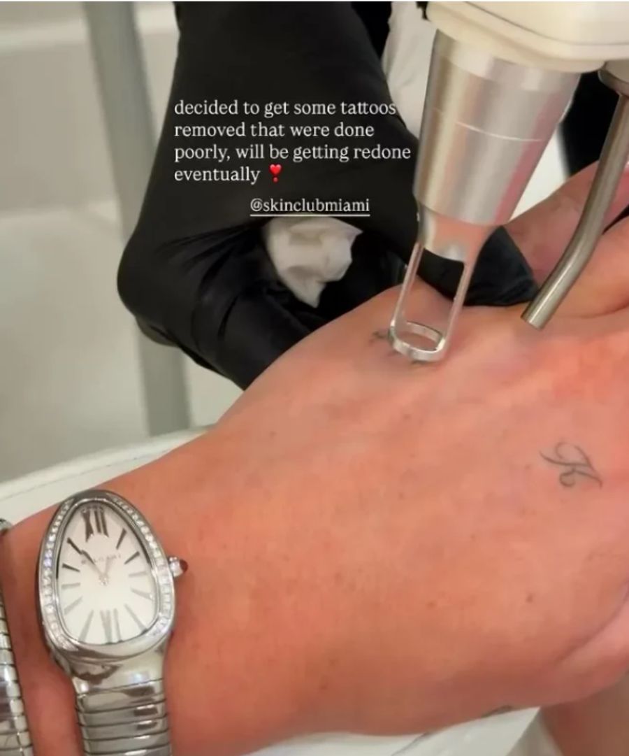 Nun lässt sie zumindest einige davon entfernen – weil die Tattoos schlecht gemacht worden seien.