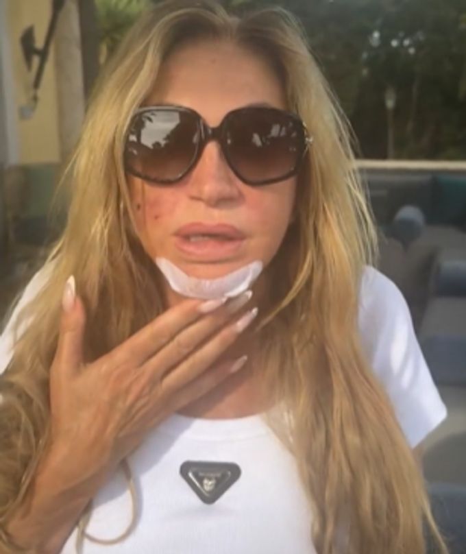 «Geissens»-Mama Carmen kann nach der Attacke kaum sprechen. Carmen Geiss
