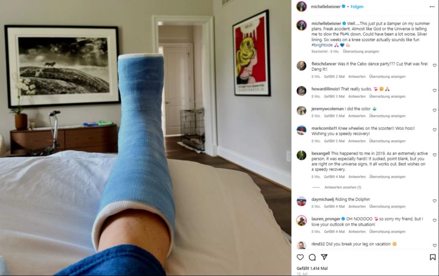 Michelle Beisner versuchte es zuerst mit einem Gips – vergeblich.