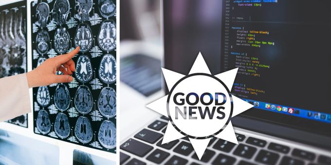 Good News - Super-Computer kann vor Hirnblutungen warnen