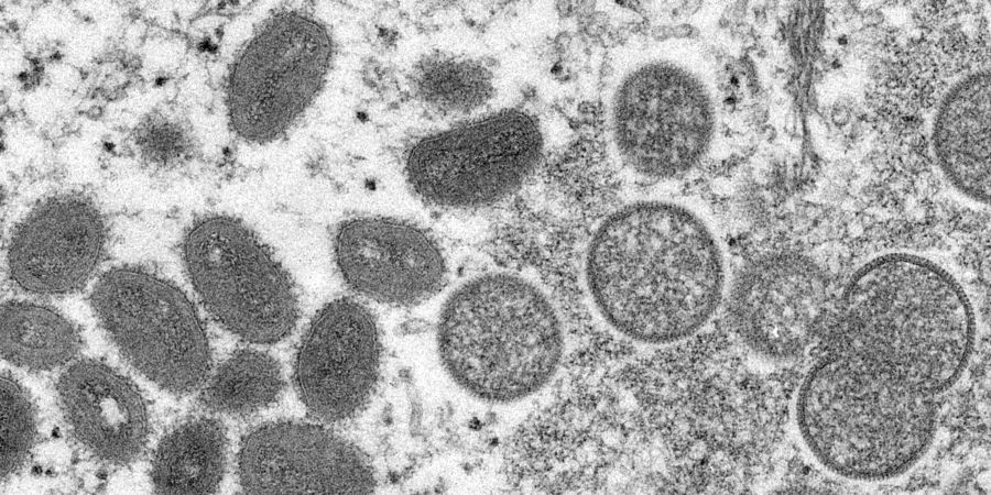 Diese elektronenmikroskopische Aufnahme zeigt reife, ovale Affenpockenviren (l) und kugelförmige unreife Virionen (r), die aus einer menschlichen Hautprobe stammt.