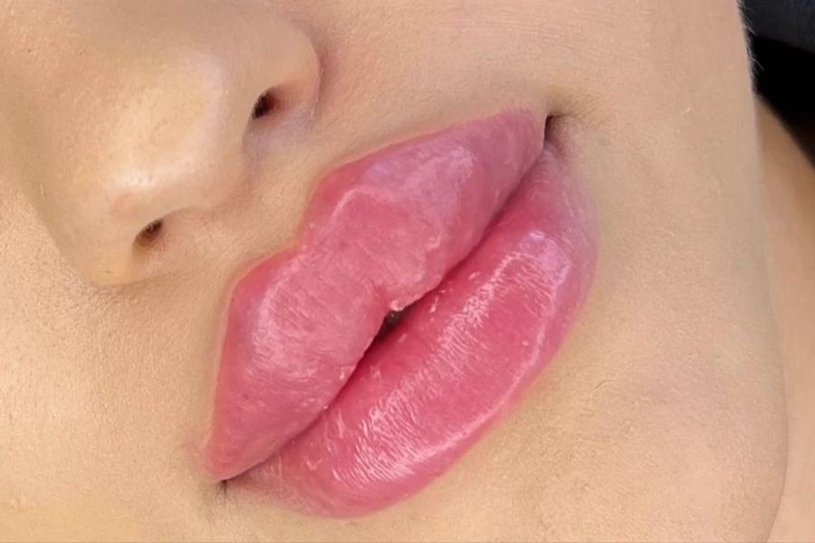 Besonders beliebt sind derzeit sogenannte «russische Lippen». Dank Social Media.