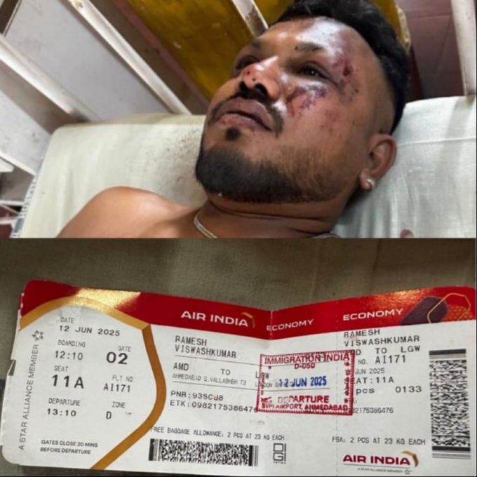 Der einzige Überlebende beim Flugzeugabsturz war Ramesh Vishwashkumar. Flugzeugabsturz