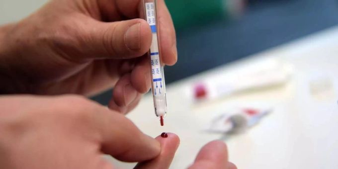 Trotz einer HIV-Infektion biss ein Mann in Deutschland einen Teenager im Streit. (Symbolbild) HIV
