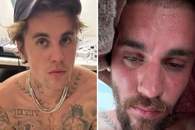 Justin Bieber