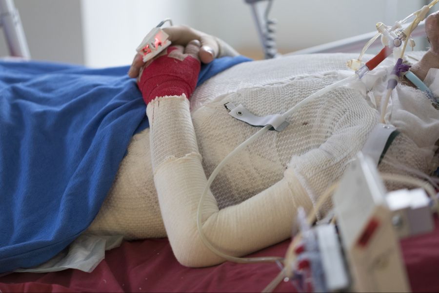 Bei knapp einem Viertel der Betroffenen wurden fünf bis dreizehn Tage nach der Einlieferung Bakterien im Blut nachgewiesen. (Symbolbild)