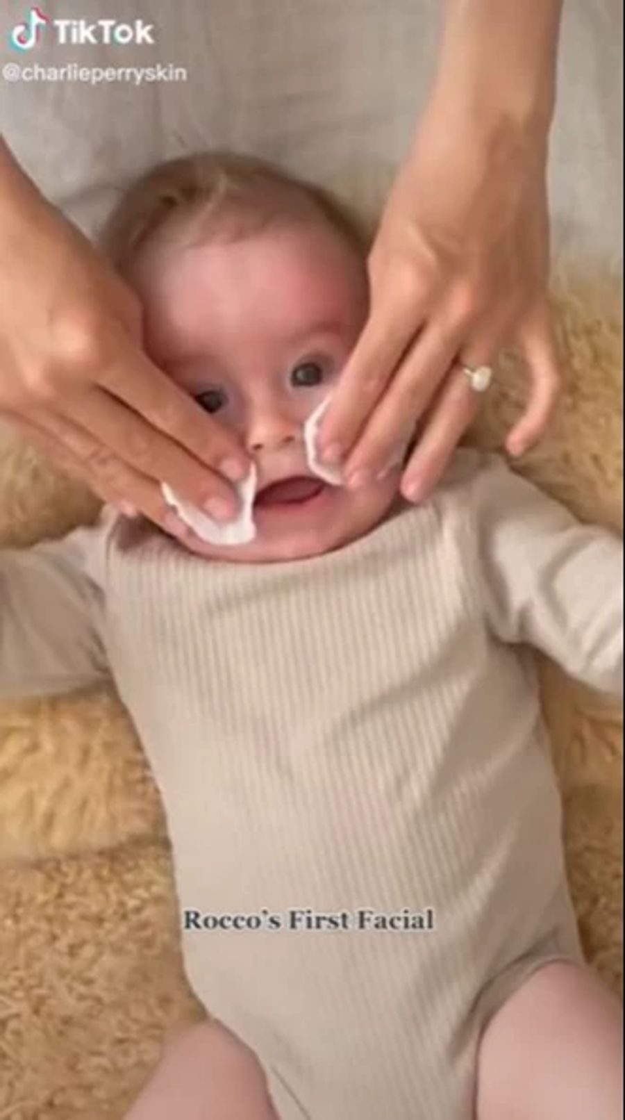 Eine Mama reinigt die Haut ihres Babys mit Wattepads.