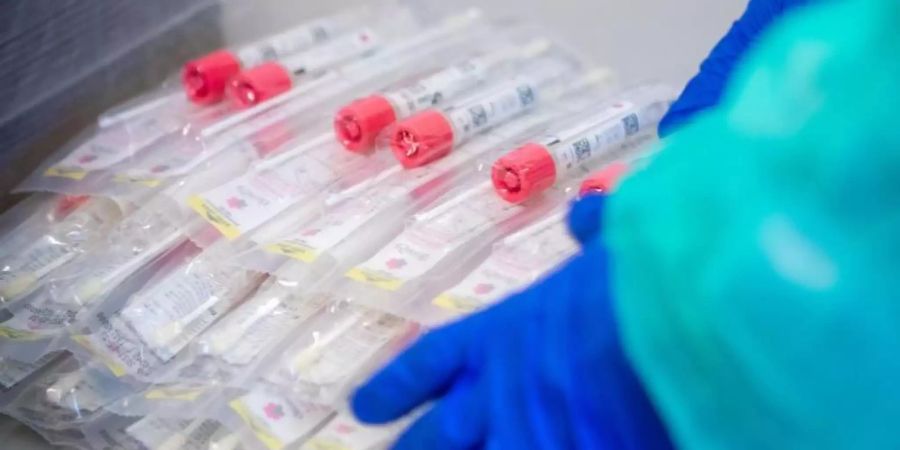 Testsets mit Abstrichstäbchen liegen in einem Testzentrum bereit. In Deutschland sind knapp 162.000 Infektionen registriert worden. Foto: Jens Büttner/dpa-Zentralbild/dpa