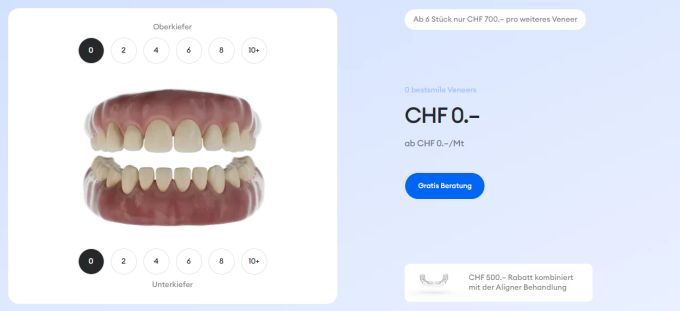 Veneers