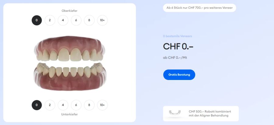 Der Trend schwappt auch zu den Normalos über: In der Schweiz werben viele Anbieter mit Veneers, etwa Bestsmile. So sehen Zähne ohne aus ...