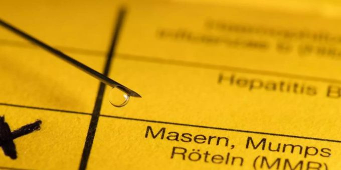 Masern gelten als Kinderkrankheit, sind aber alles andere als harmlos. Masernfall Impfen