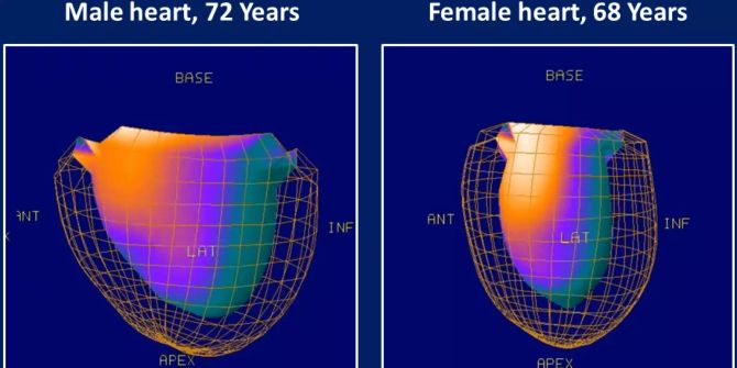 Gendermedizin Herzen