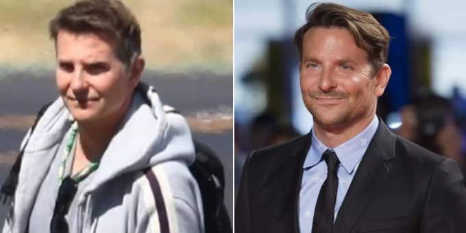 Fans sind stutzig - War Leinwand-Beau Bradley Cooper beim Beauty-Doc?