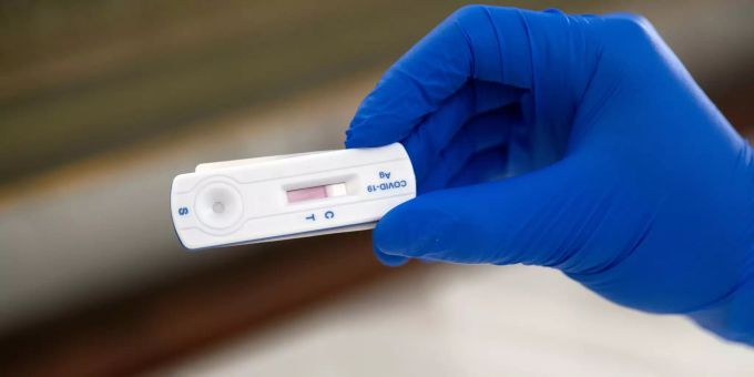 Schnelltests zum Coronavirus vor Treffen sind laut Andreas Cerny eine gute Idee. (Symbolbild) Coronavirus Schnelltest