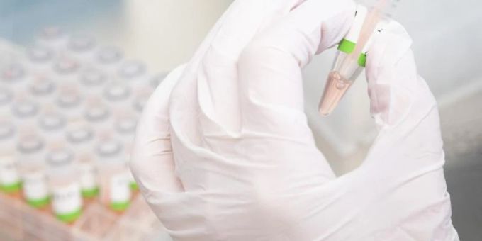 Es wird vermutet, dass viele Menschen ihre Infektion nicht mehr über einen PCR-Test bestätigen lassen. Foto: Julian Stratenschulte/dpa Es wird vermutet, dass viele Menschen ihre Infektion nicht mehr über einen PCR-Test bestätigen lassen. Foto: Julian Stratenschulte/dpa