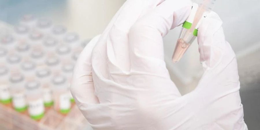 Es wird vermutet, dass viele Menschen ihre Infektion nicht mehr über einen PCR-Test bestätigen lassen. Foto: Julian Stratenschulte/dpa
