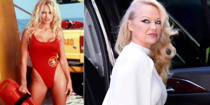 Nach Beauty-Eingriff? - Ex-Baywatch-Nixe Pamela ganz Anders(on)