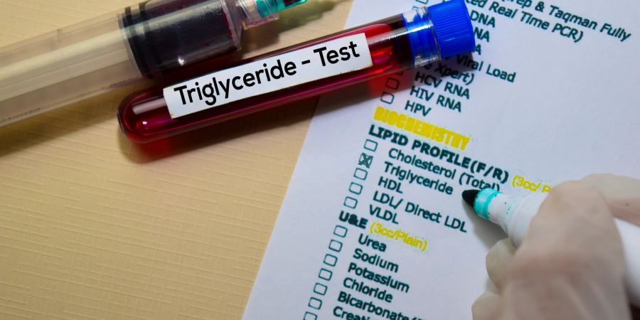 Triglyceride