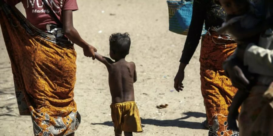 Mangelernährtes Kind im Dorf Befeno im Süden von Madagaskar