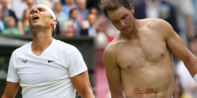 Sieben Millimeter - Nadal will trotz Bauchmuskel-Riss in Wimbledon ran