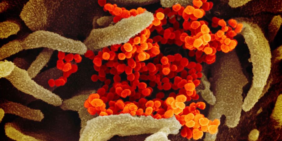 Das Coronavirus (SARS-CoV-2) (orange), das aus der Oberfläche von im Labor kultivierten Zellen (grau) austritt. Die Probe wurde von einem Patienten in den USA isoliert.