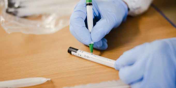 Ein Test gibt Auskunft darüber, ob man an der Vogelgrippe erkrankt ist. Vogelgrippe Test