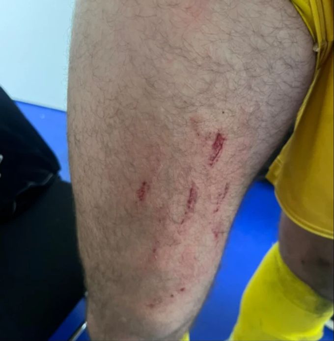 Winti-Goalie Stefanos Kapino ist nach dem Spiel gegen Luzern gekennzeichnet. Stefanos Kapino FC Winterthur