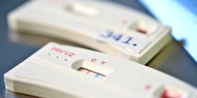 HIV-Schnelltests zeigen an, ob jemand das Virus in sich trägt. (Archivbild) hiv impfung